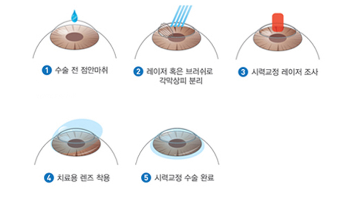라섹이미지